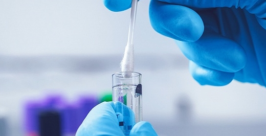 厦门核酸检测哪里查结果